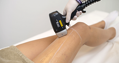 Full Body Laser Hair Reduction